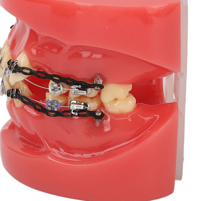 Professional Dental Demonstration Orthodontic Model with Metal Wires and Bracket