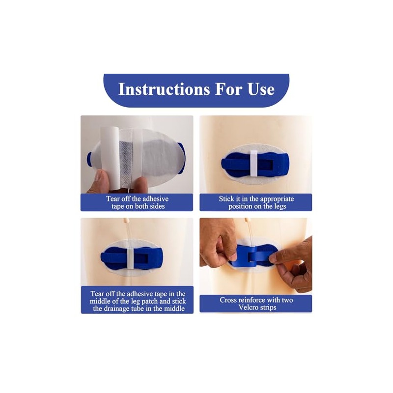5 Catheter Stabilisation Patches for Foley, PEG and G-Tubes, Blue