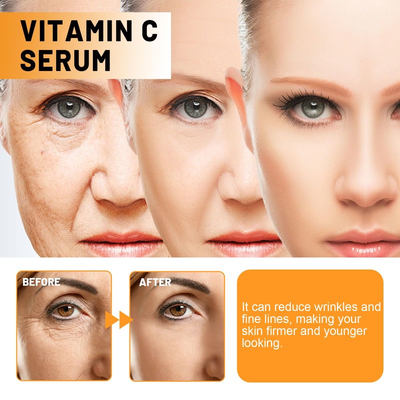 Vitamina C Facial Serum - Face Serum for Women, Intense