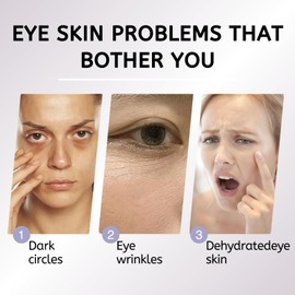 Retinol Eye Stick, Retinol Eye Cream, Anti Aging Eye Cream for Dark Circles and Puffiness, Retinol Eye Balm Stick with Vitamin E, Brightening, Smoothens Wrinkle & Reduces Fine Lines, 6g