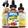 Aceite De Rosa Mosqueta Con Vitaminas A, C Y E
