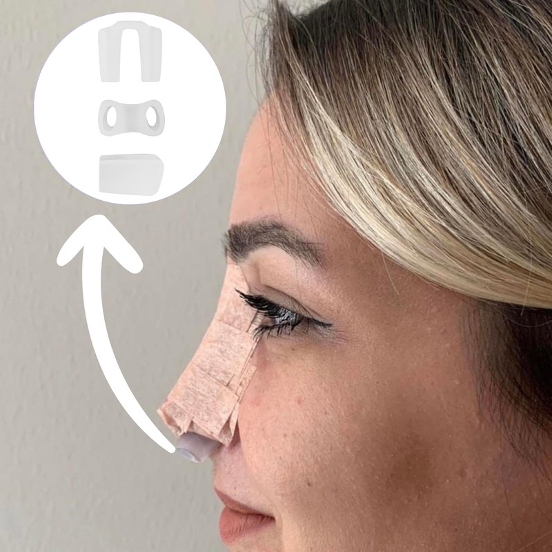 Nostril Retainer Short Model | Nostril Retainer Rhinoplasty | Nasal