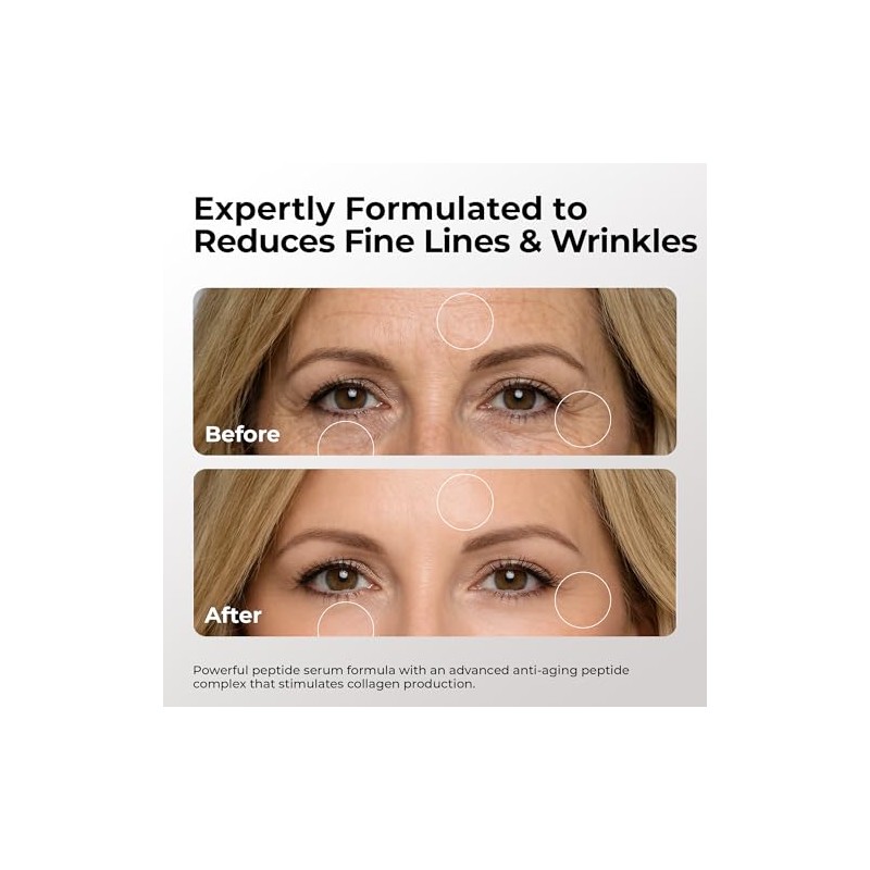 Matrixyl 3000 Serum with Hyaluronic Acid 1oz - super intense