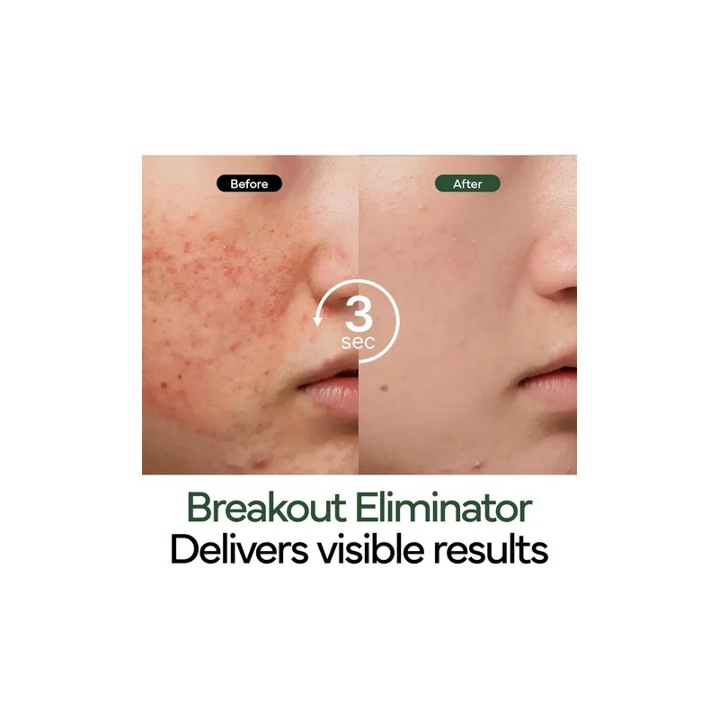 Ivoskin Crema Coreana Reparadora Intensiva De Cica Acn Sensible Danoche