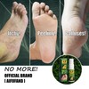 7 Day Foot Spray for Smelly Feet & Foot Odor–