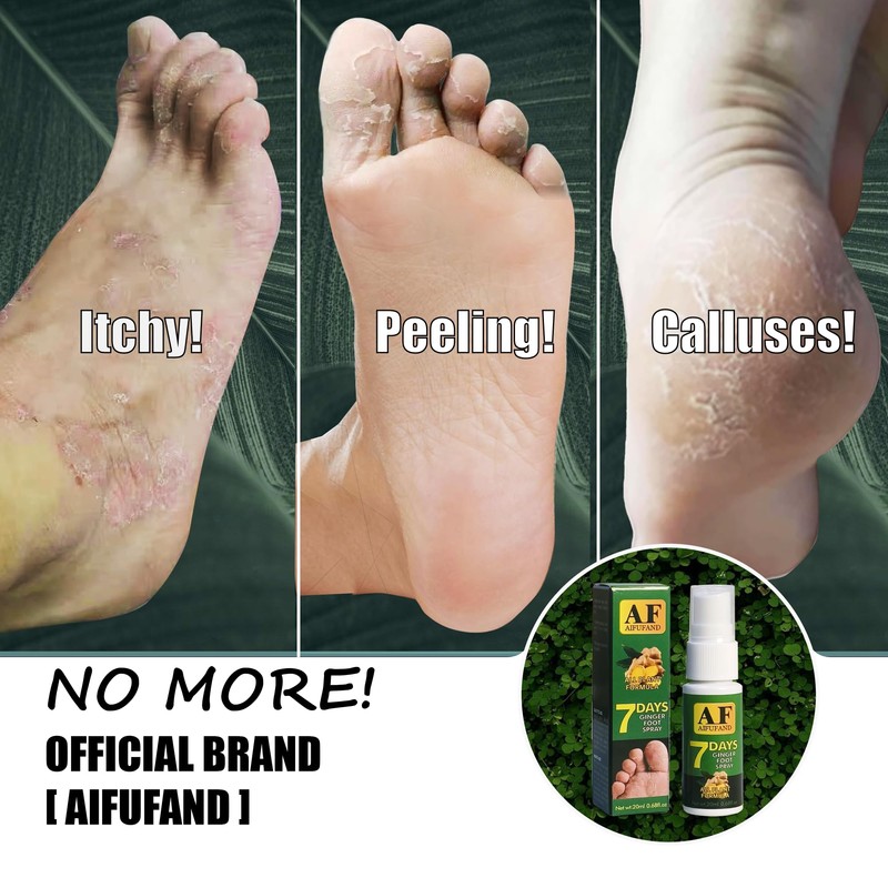 7 Day Foot Spray for Smelly Feet & Foot Odor–