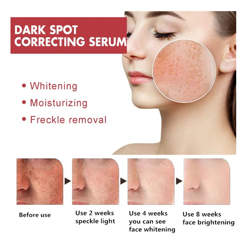 2pcs Suero Corrector De Manchas Oscuras Con Niacinamida