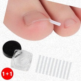 Ingrown toenail band, toenail correction band, correction band, toenail, ingrown toenail tape, ingrown nail (send in double quantity of order), see detailed page ml, 1 piece, ingrown toenail tip 10p / 내성발톱밴드 발톱교정밴드 교정밴드 발톱 내성발톱테이프 내성손톱(주문의2배수량 발송), 상세페이지 참조ml, 1개, 내향발톱팁10p