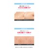 [G9SKIN] ZERO SOLUTION SPOT COVER PATCH (1 piece x 36