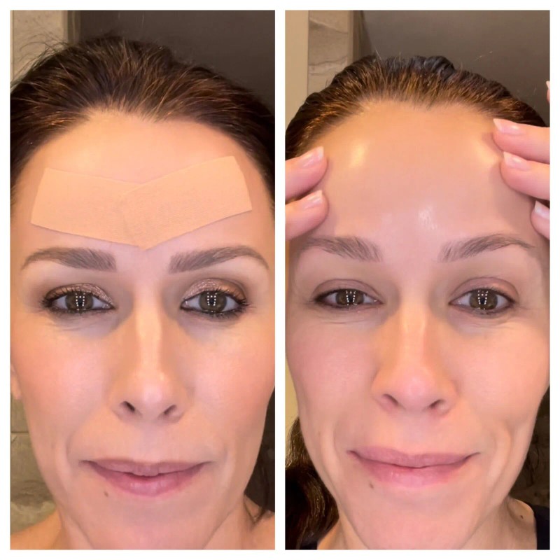 True Beauty Skin Expert Kinesiology Tape For Face Wrinkle Reducer