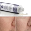 Anasis 아클레온 여드름 약산성 시카 토너 2개 400ml Acleon Acne