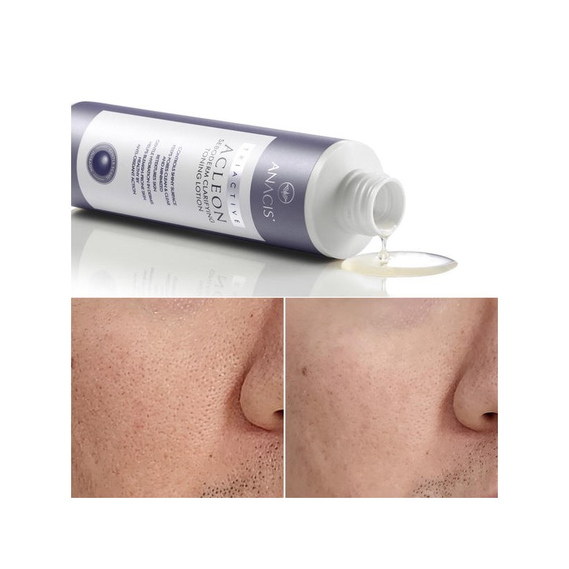 Anasis 아클레온 여드름 약산성 시카 토너 2개 400ml Acleon Acne
