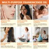Frankincense Oil for Skin, 100% Pure and Natural Organic Frankincense