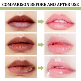 Dark Lips Cream,Hydrating & Brightening Dark Lips,Lip Pigmentation Treatment,Lip Plumping Serum,Relieve Dryness,Moisturizing and Hydrating,Smooth and Easy to Apply,Comfortable and Not Sticky