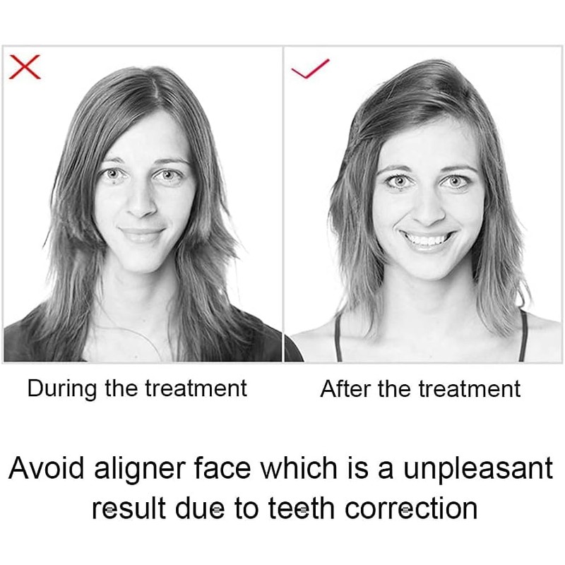 3PCS Orthodontic Chewables Orthodontic Chewables, Orthodontic Chews for Tray Retainers,