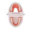 Dental Typodont Teeth Model with Orthodontic Metal Bracket for Dentist
