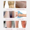 Varicose Veins Relief