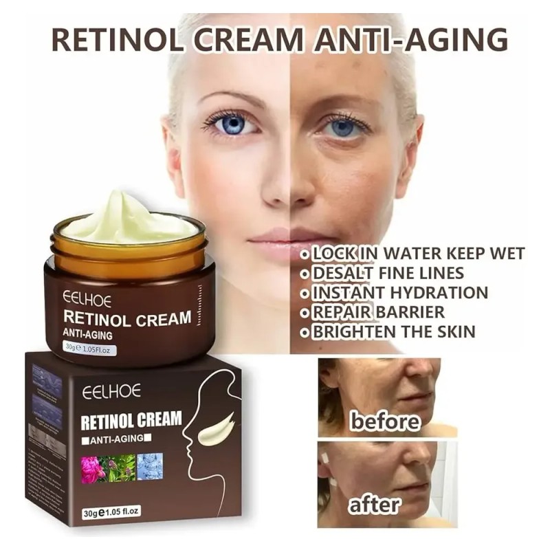 Ee Crema Retinol Anti Aging Anti Edad Reafirmante, Dia Noche