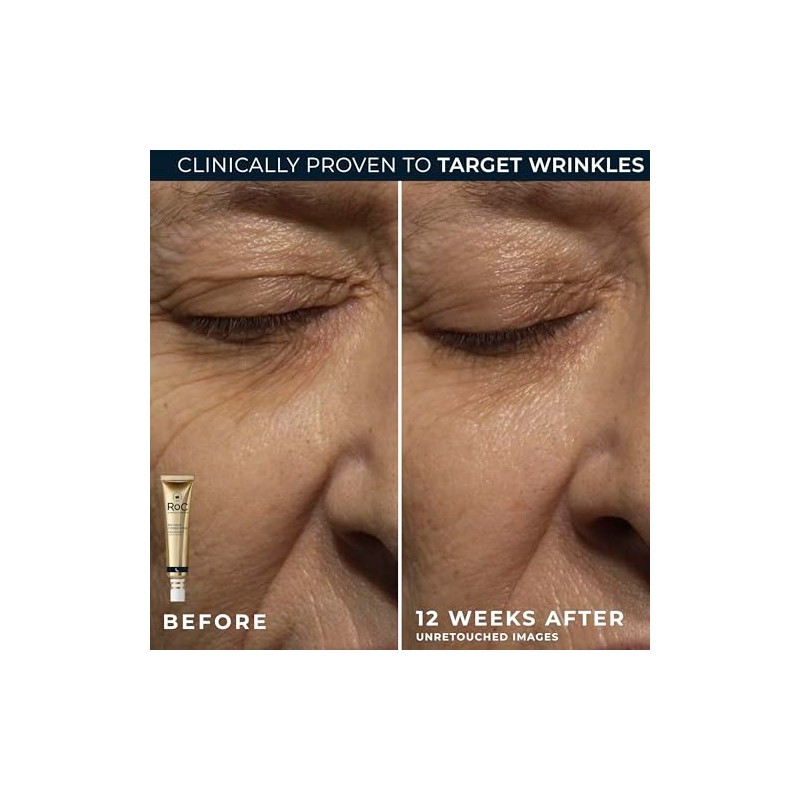 RoC Retinol Correxion Deep Wrinkle Repair Pack