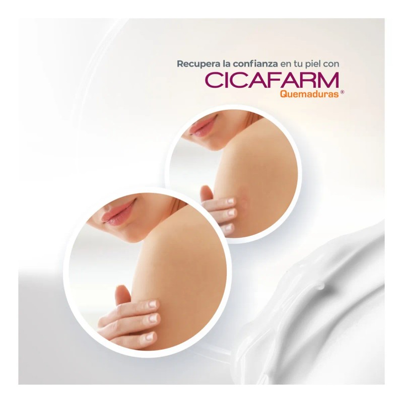 Crema Cicatrizante Para Quemaduras Superficiales Cicafarm Q