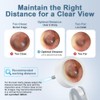 Aspoven Otoscope Ear Camera with Light, 1.4” Screen 1080P HD
