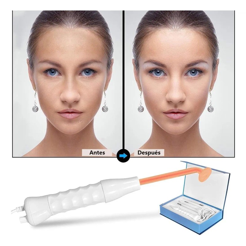 Hysmart®Máquina terapia piel facial dispositivos de alta frecuencia blanco