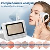Skin Hair Analyze,Scalp Analysis Machine,5 Inch LCD Screen Rechargeable Digital