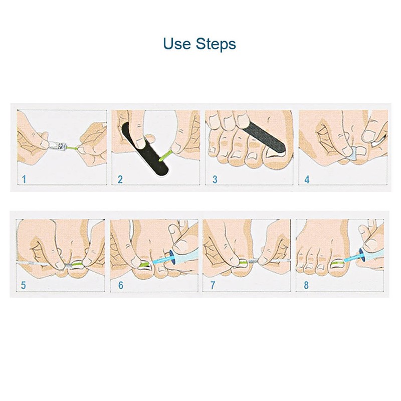 7Pcs Pedicure Ingrown Toenail Correction Recover Tool Set Nail Pusher