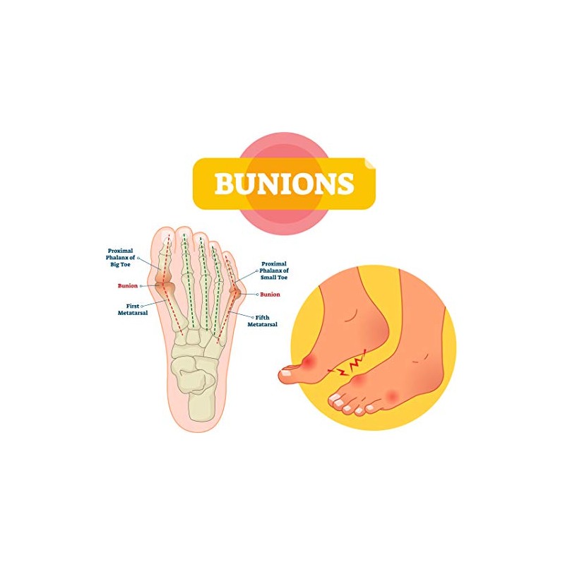 Pedag Hallux & Forefoot pad