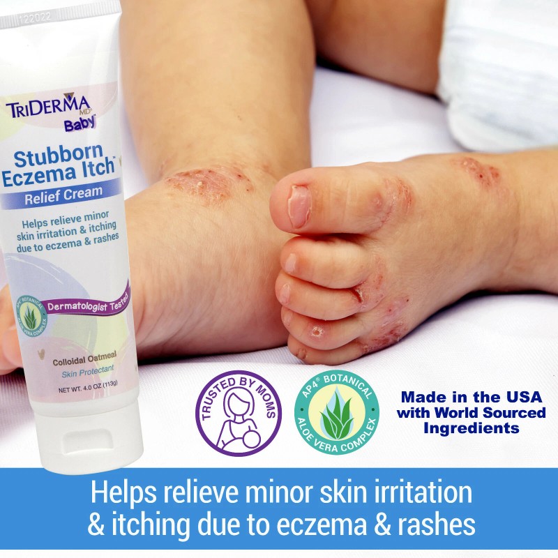 TriDerma Baby Stubborn Eczema Itch Relief Cream Soothing for Sensitive