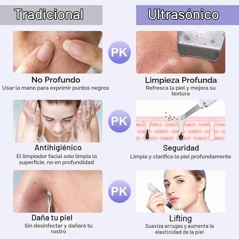 Peeling Ultrasónico Facial LOTOVERDE con 4 Modos y Limpieza Profunda