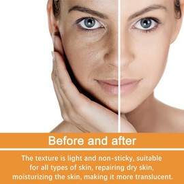 Vitamin C Serum for Face,Facial Serum with Vitamin C&Hyaluronic Acid,Anti Ageing & A/nti Wrinkle Se/rum,Brighten Hydrate&Plump Skin,Even Skin Tone,Anti-Dark Spots,Sk/in Tightening Cream for Face