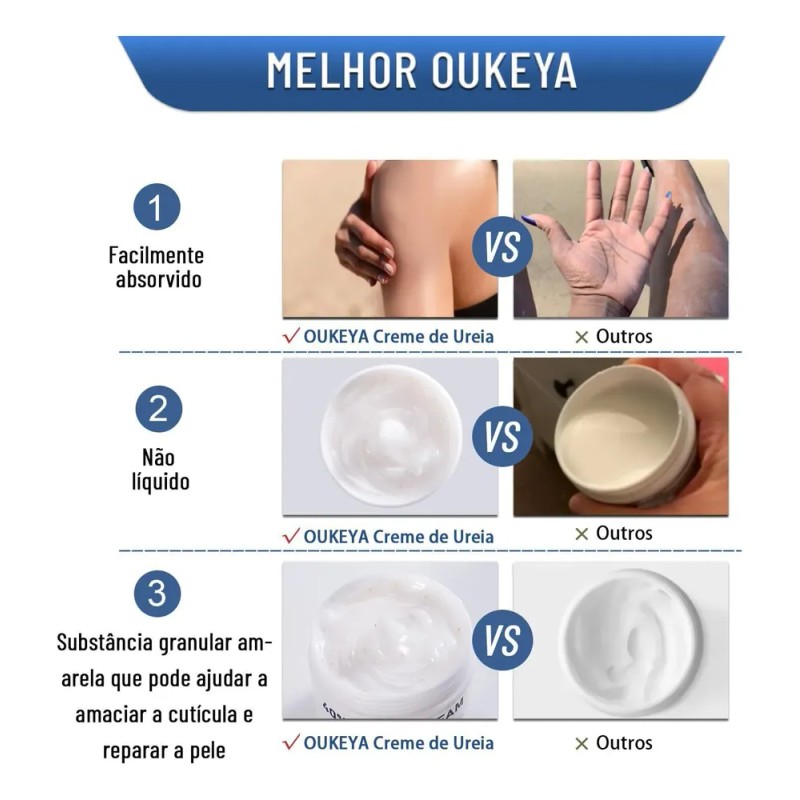 Crema Para Pies Al 40% Con Urea