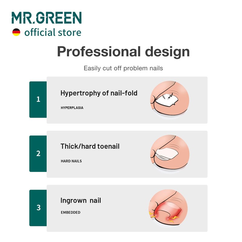MR.GREEN- Cortaúñas cómodo y profesional, diseño de olécranon preciso y