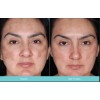 Crema Antimanchas Obagi Nu-Derm Clear Hipoalergénica Sin Parabenos 57ml