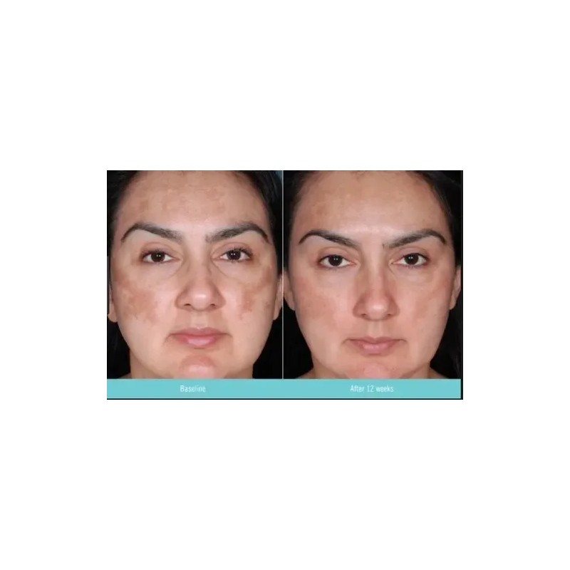 Crema Antimanchas Obagi Nu-Derm Clear Hipoalergénica Sin Parabenos 57ml