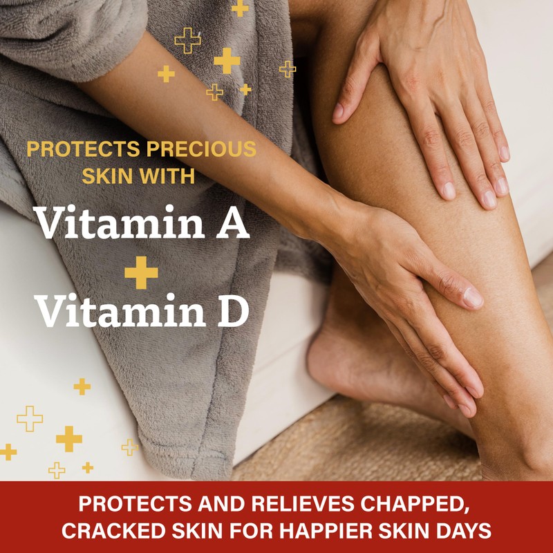 A+D First Aid Healing Ointment - Moisturizing Skin Protectant for