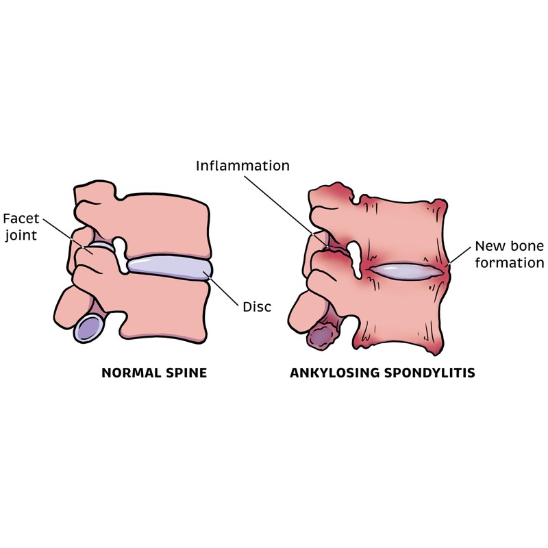 Rheumatology Made Ridiculously Simple