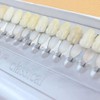 Prefer warehouse 3D-Master Teeth Whitening Shade Guide 16 Colors Set