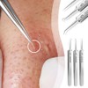 3 Pcs Professional Blackhead Tweezer Professional Facial Blackhead Remover Tweezers