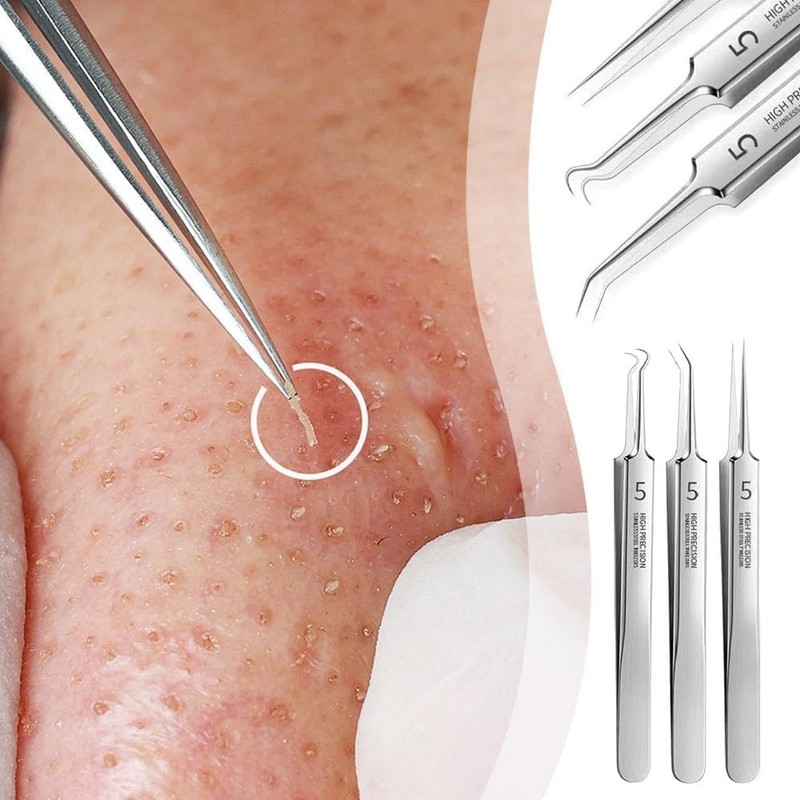 3 Pcs Professional Blackhead Tweezer Professional Facial Blackhead Remover Tweezers