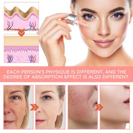 5-In-1 Facial Serum, Rice 5-In-1 Face Serum,Advanced Collagen Boost Anti Ageing, Moisturising And Nourishing, Improve Dull gesichtsserum