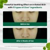Dr.g Red Blemish Clear - Crema Hidratante Coreana Calmante P