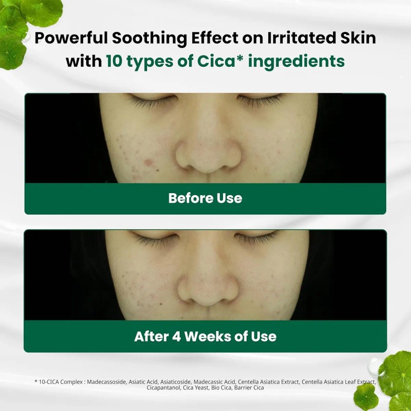 Dr.g Red Blemish Clear - Crema Hidratante Coreana Calmante P