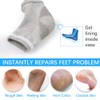 Moisturizing Socks, Moisturizing/Gel Heel Socks for Dry Cracked Heels, Ventilate