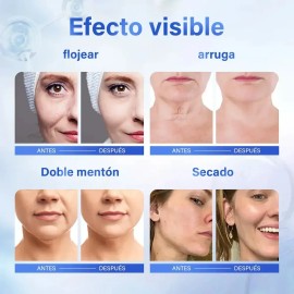 Ácido Azelaico Crema Con 20% Vitamina C Y Niacinamida