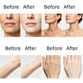 Aceite corporal elevador de colágeno - Colágeno para estirar la piel, de rápida absorción después de la ducha para mujeres - Reduce las líneas finas, suaviza la piel, seda antienvejecimiento (2 piezas)