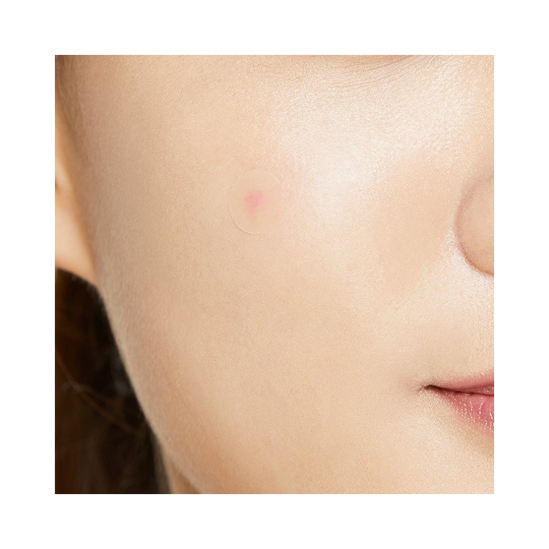 COSRX [5 Pack] COSRX Acne Pimple Master Patch 24 Patches_Wound,