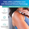 ScarAway Advanced Clear Silicone Scar Sheets, Medical Grade Silicone Strips