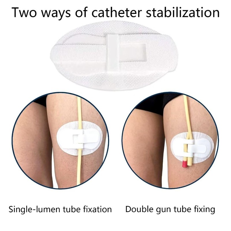 Flosmore 5 Pcs Catheter Stabilization Devices,Catheter Supplies,Foley Catheter Urinary Leg